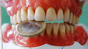 Nützlich oder nicht – die Zahnzusatzversicherung